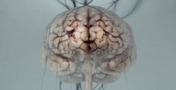 Brains: The Mind As Matter